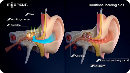 What protective benefits do bone conduction hearing aids offer compared to traditional air conduction hearing aids?